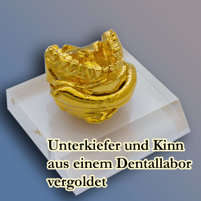 Unterkiefer und Kinn aus einem Dentallabor, vergoldet
