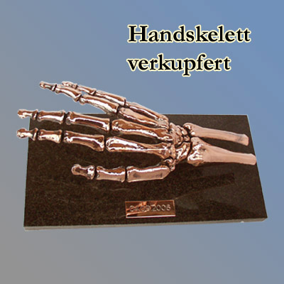 Skelett Hand, verkupfert